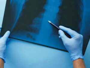 The Hidden Factors That Shape Positive Surgical Outcomes