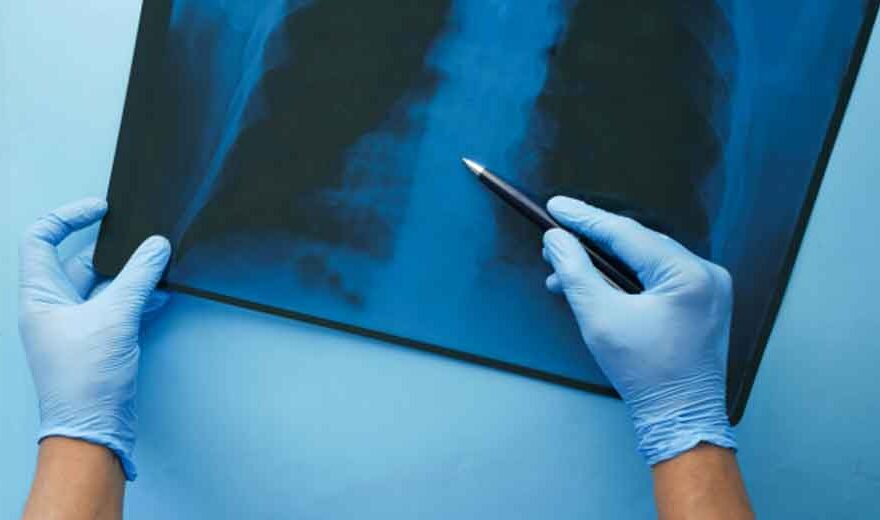 The Hidden Factors That Shape Positive Surgical Outcomes